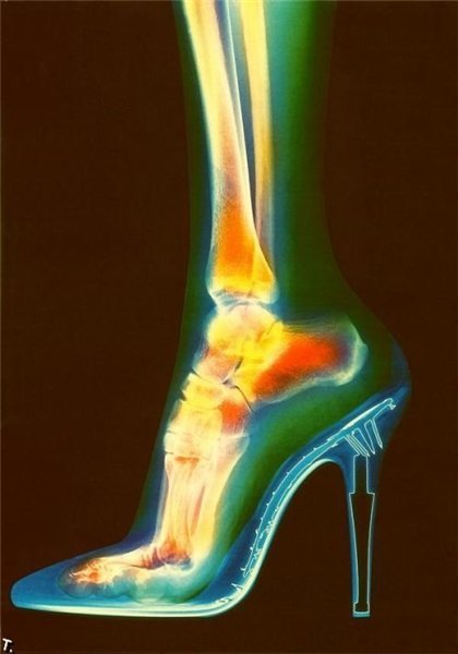 Фото Женская ножка в туфле просвеченная через рентген