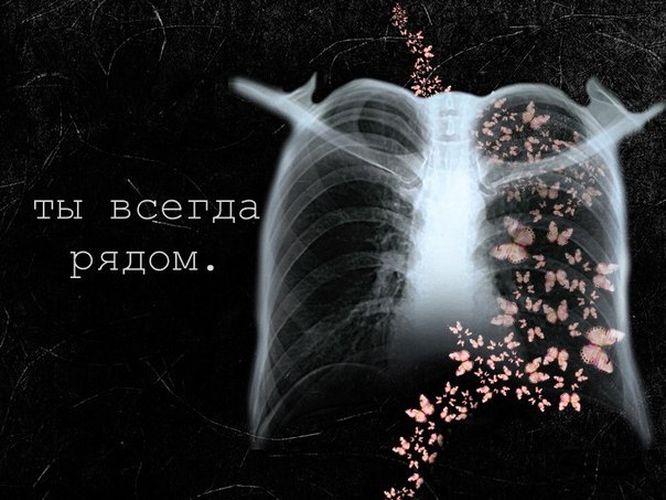 Рентген бабочки в животе картинка