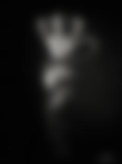 Фото Девушка, с забинтованным лицом, обвита удавом, автор Gonzalo Villar / Гонзало Виллар